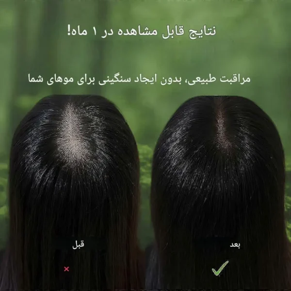 صابون مو سون هربال